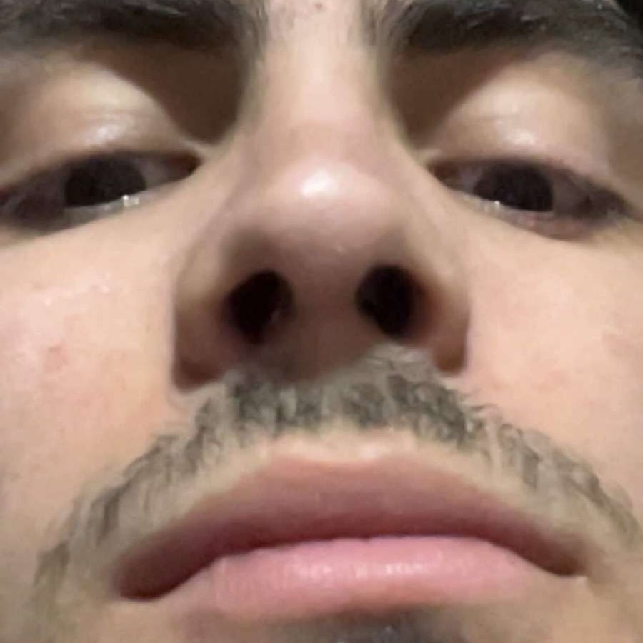Wiploo