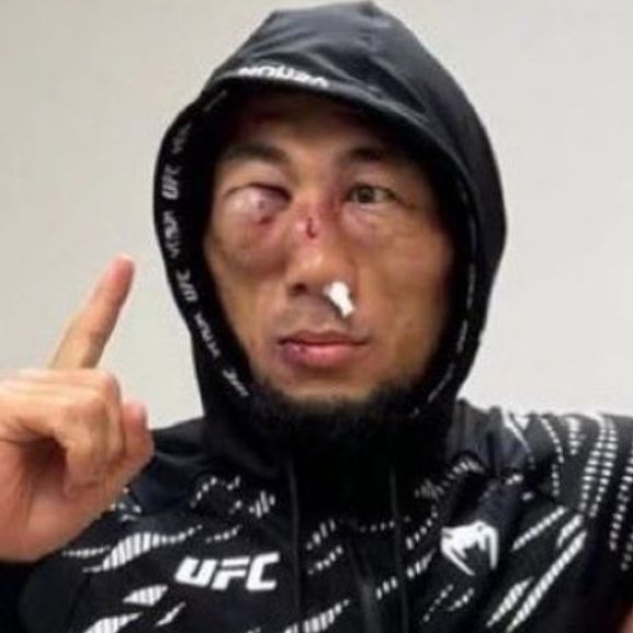 UFC
