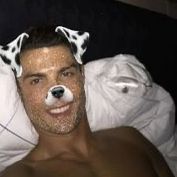 airscalp
