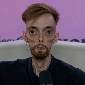 -fkk