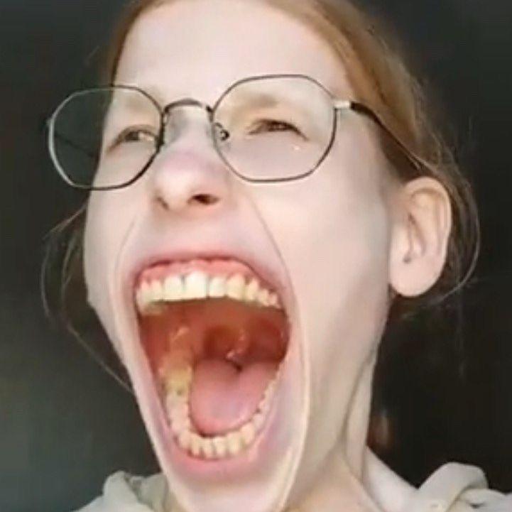 ashotig