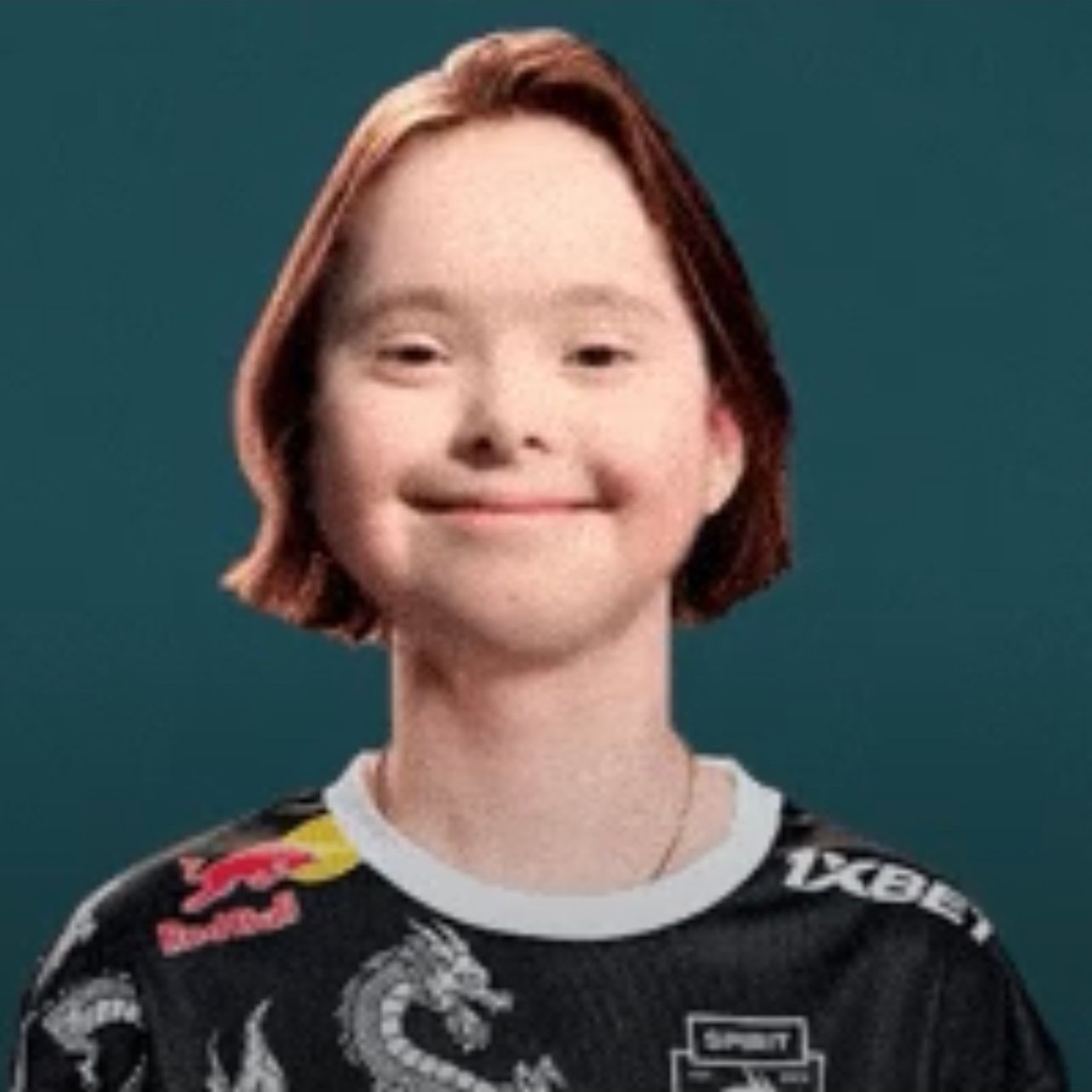 Skert1