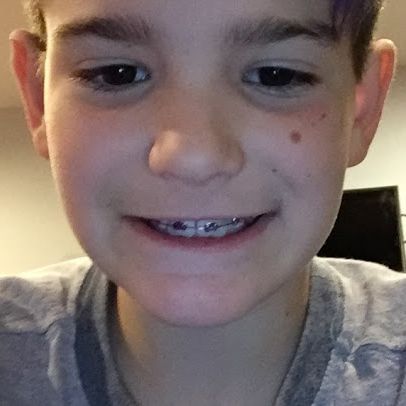 Dart_Monkey_