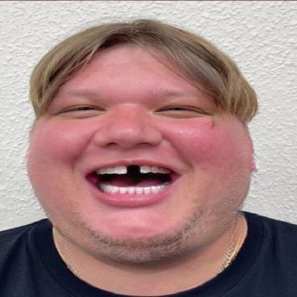 nadoELO
