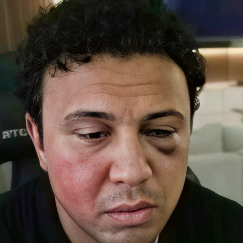 TIMOXA_BMW