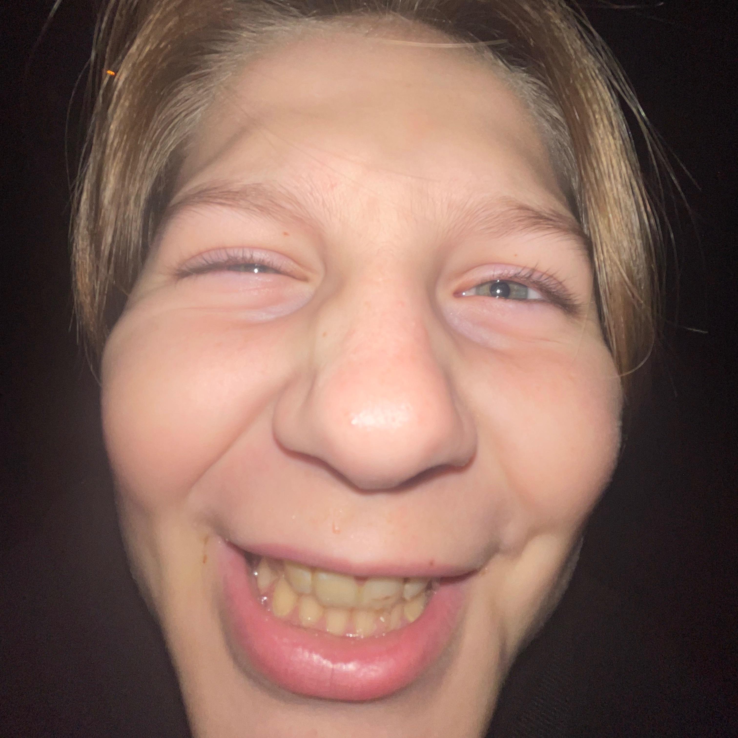 Garsonn