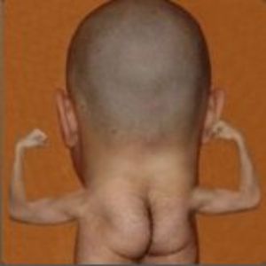 Bipson