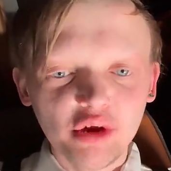 Gjoelz
