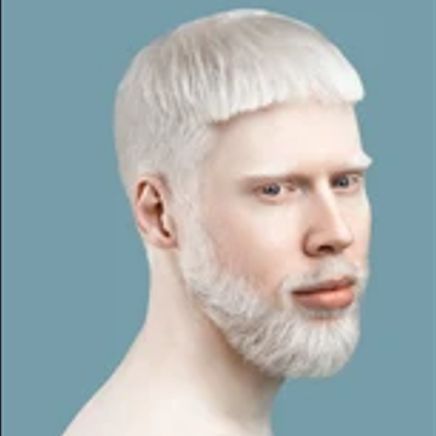 MilkyWhite