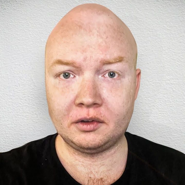 Avant_10