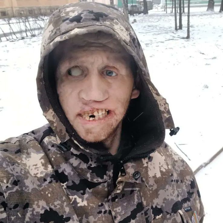 pLIKDI