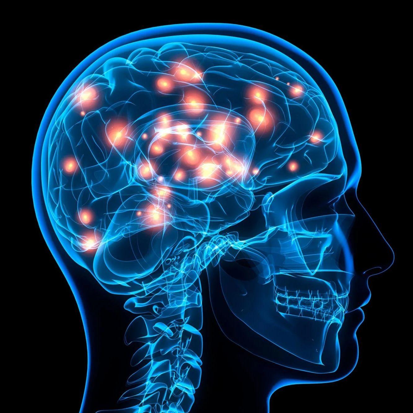 DOPAMINE