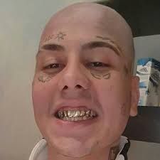 Duki_Pelado