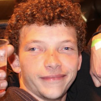 Strabismus1