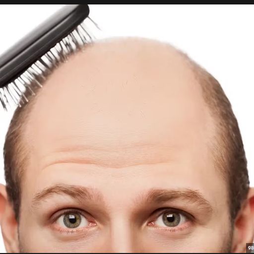 Hair recovery