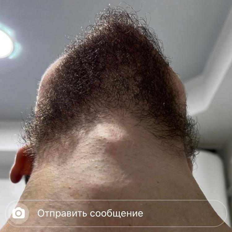 igjnn