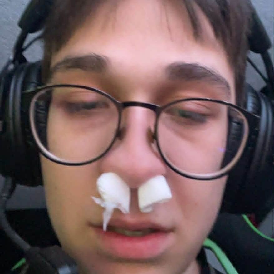 P0X1E