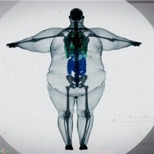 BigBone2
