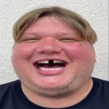 FAZESchradin