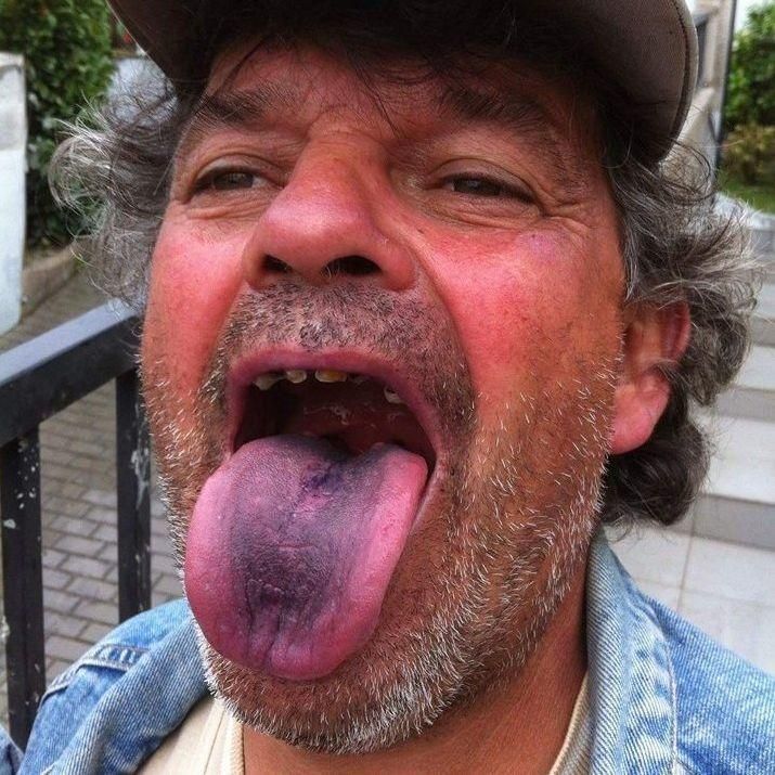 Adrianzo
