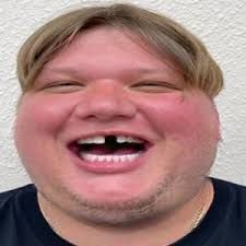 Lukkiz1