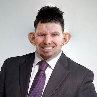 dolbognom_