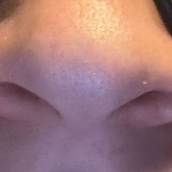 eblanityt