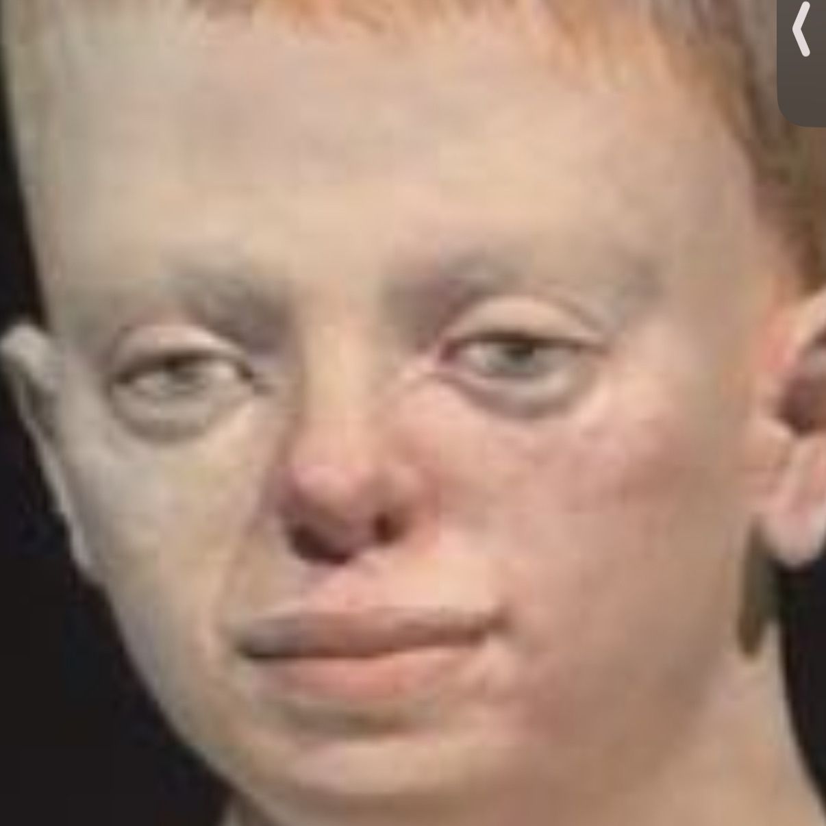 zedera_