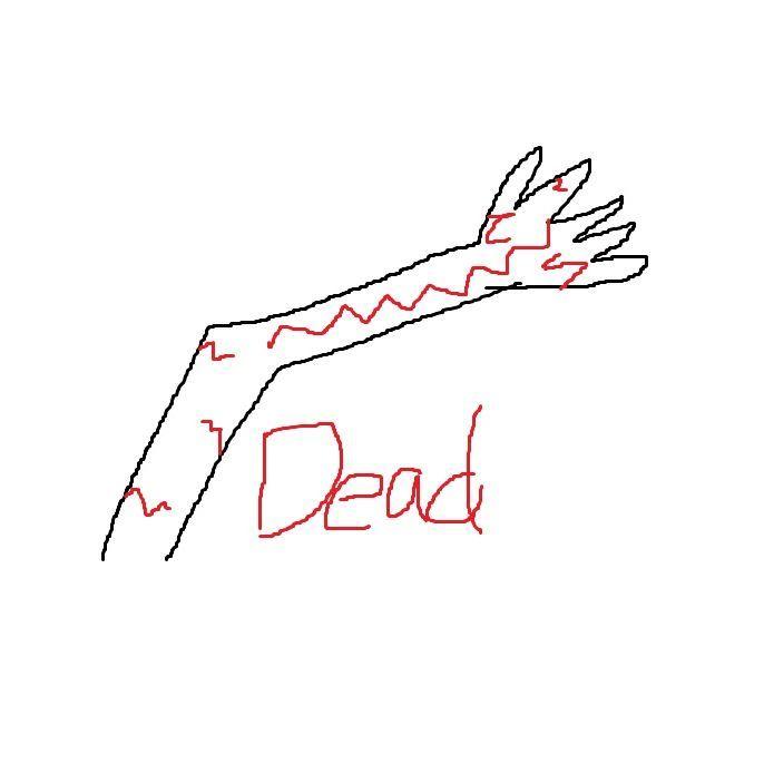 Juan Arm