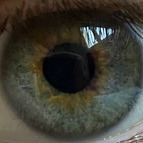blinddura