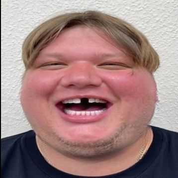 -A1Mple