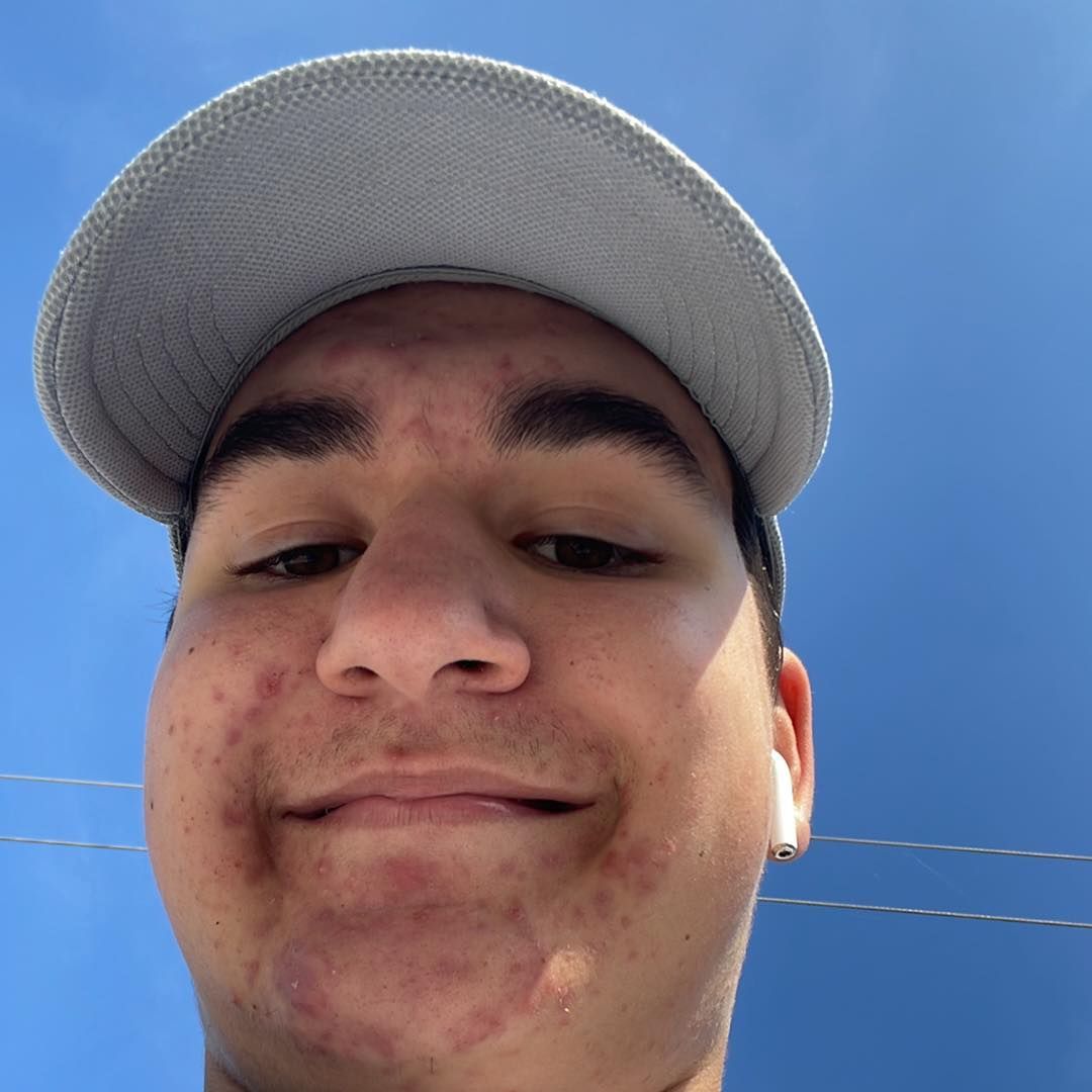 Faceit Avatar