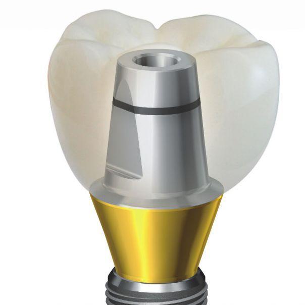 dentium