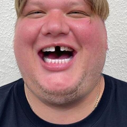 Grreeeeeeeed