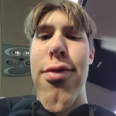 backstrassi