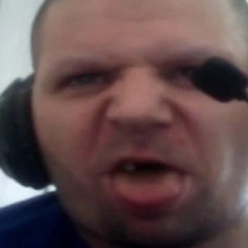 scvv-