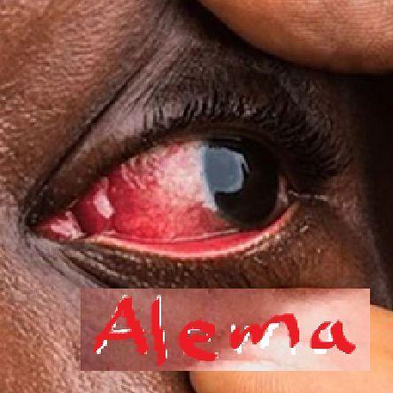 Alema avatar