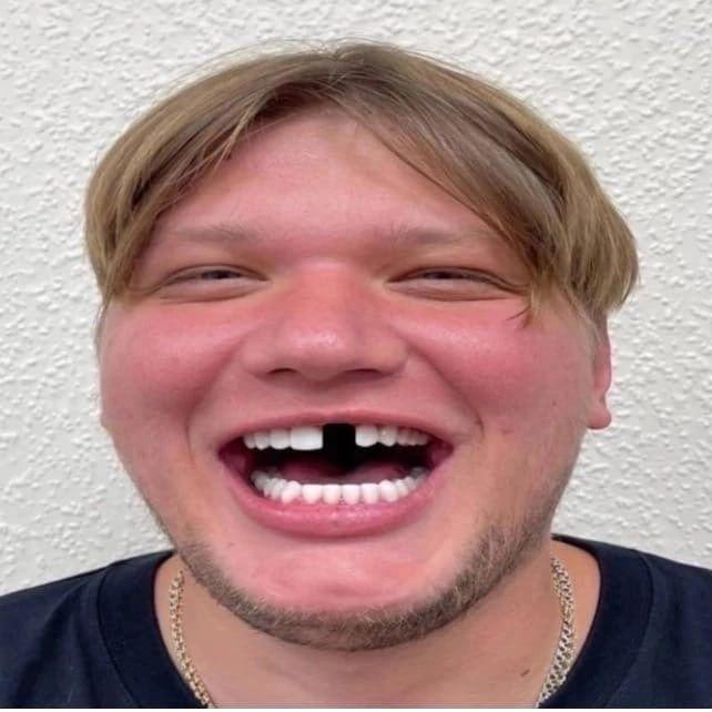 DitCaNhau