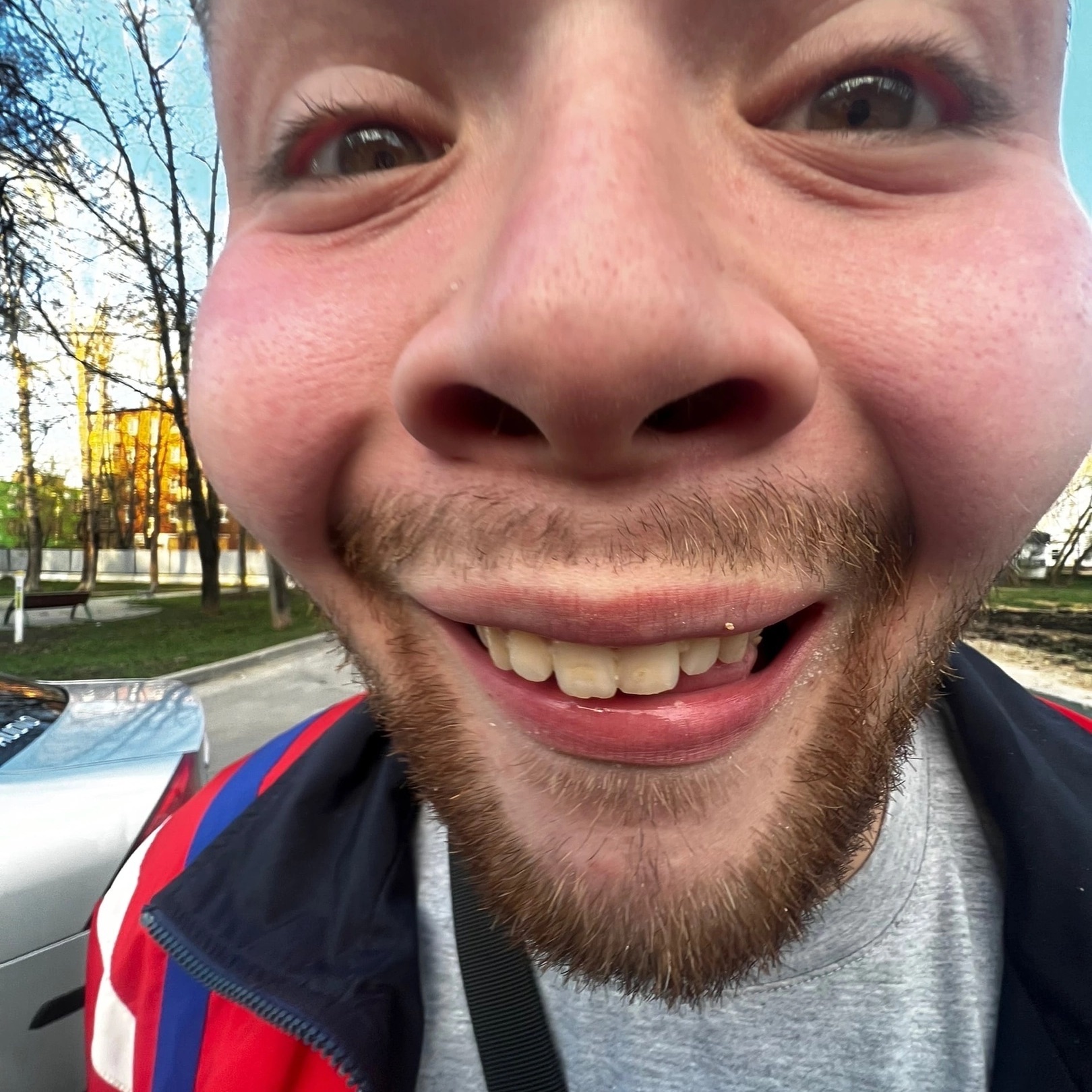 xyesospik