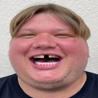 vektus