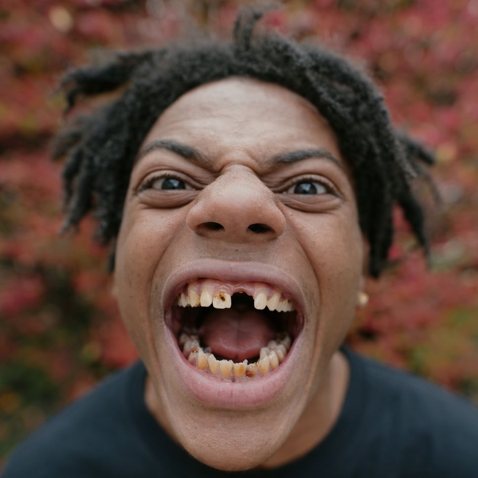 IShowTeeth